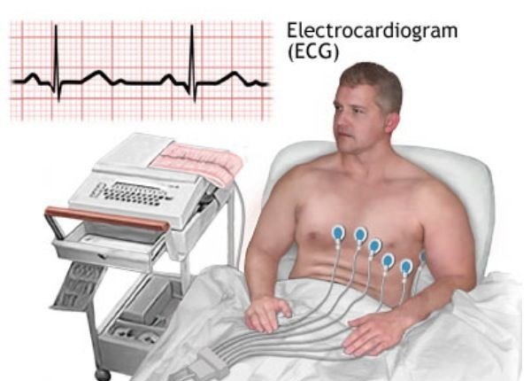 Stress echocardiography service at Trivedi Cardiac Care Clinic