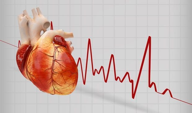 Arrhythmia treatment service at Trivedi Cardiac Care Clinic