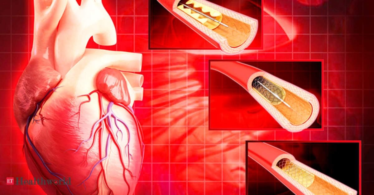 PCI service at Trivedi Cardiac Care Clinic